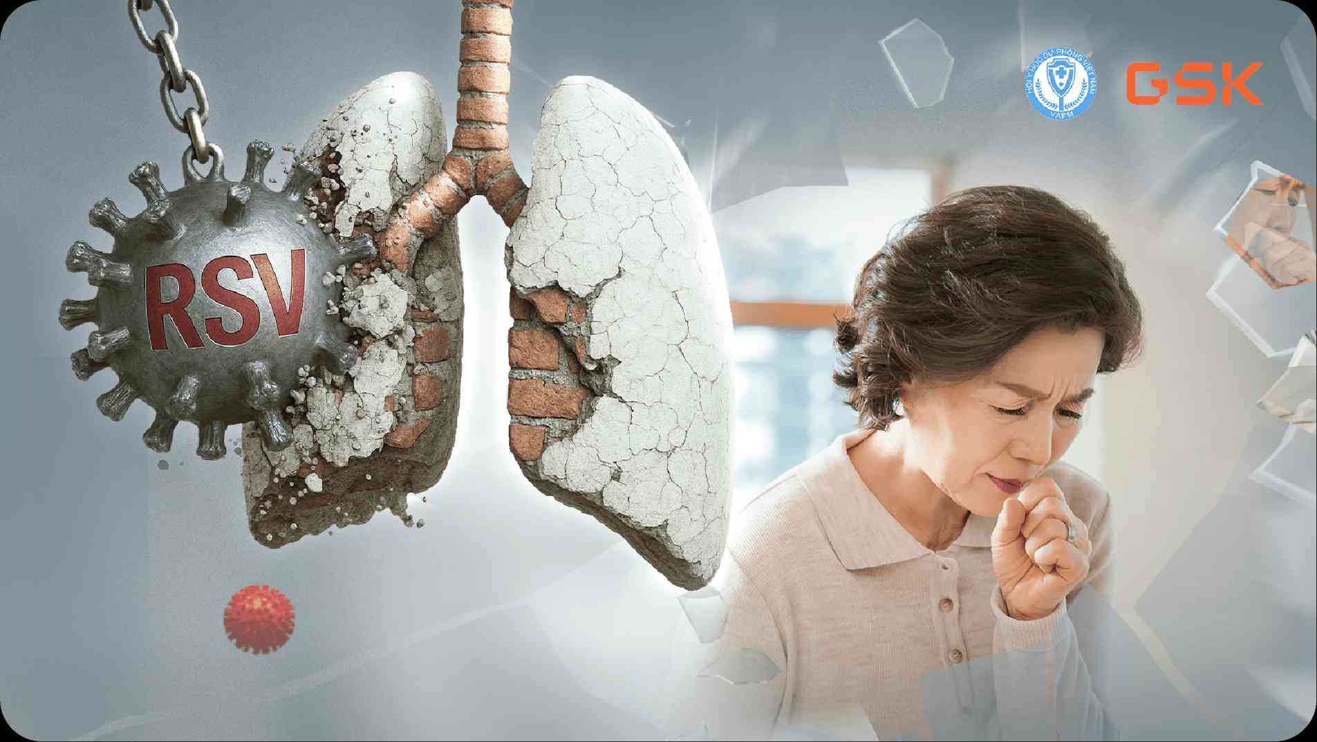 Bệnh đường hô hấp dưới do vi rút hợp bào hô hấp(RSV)